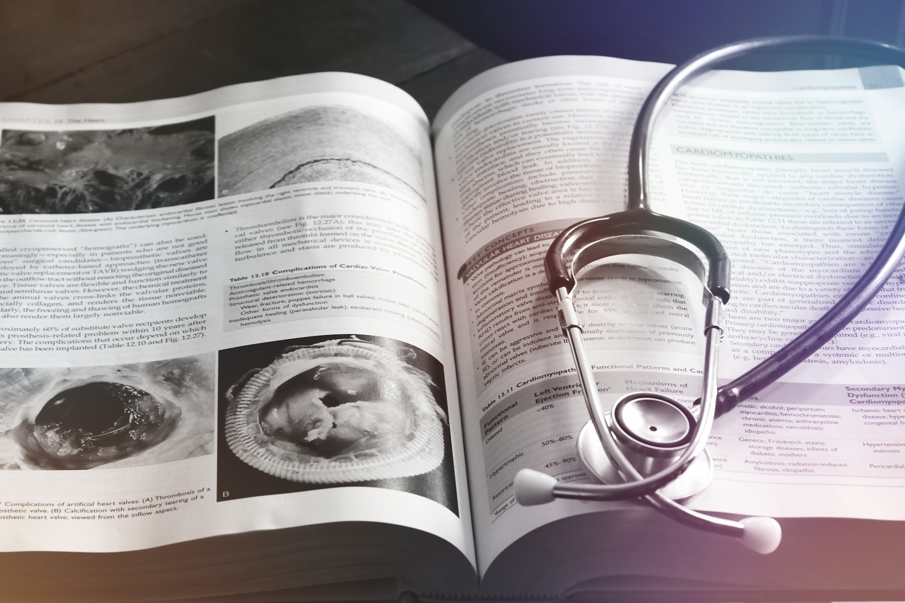 A stethoscope resting on an open medical book